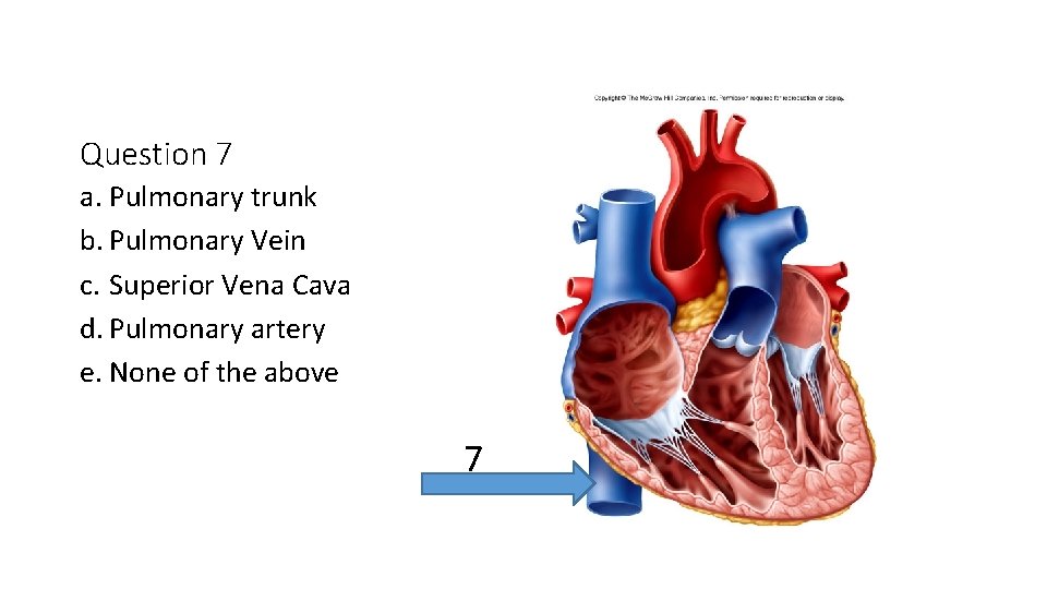 Question 7 a. Pulmonary trunk b. Pulmonary Vein c. Superior Vena Cava d. Pulmonary