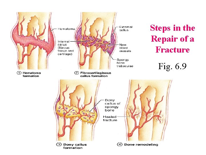 Steps in the Repair of a Fracture Fig. 6. 9 