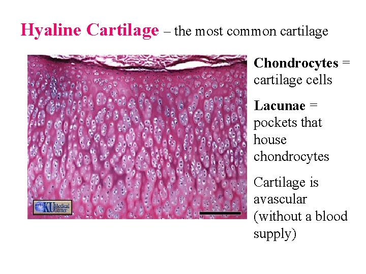 Hyaline Cartilage – the most common cartilage Chondrocytes = cartilage cells Lacunae = pockets