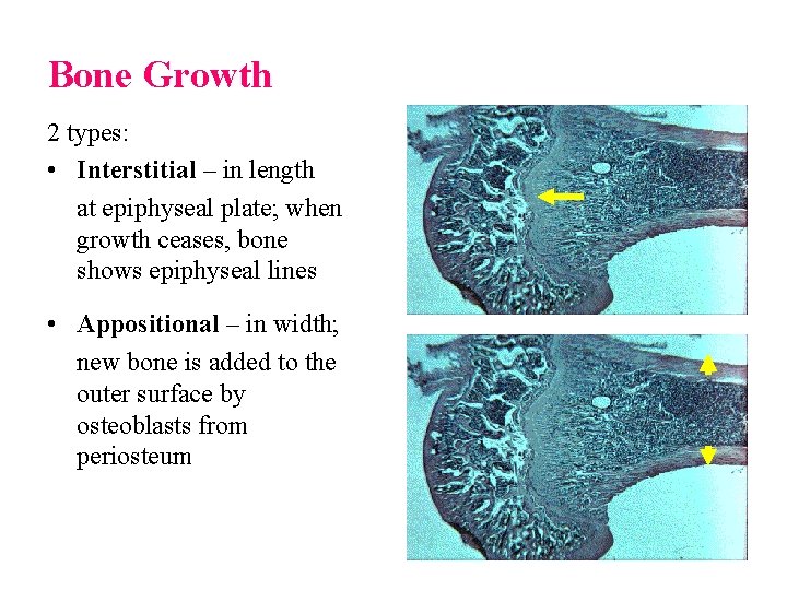 Bone Growth 2 types: • Interstitial – in length at epiphyseal plate; when growth