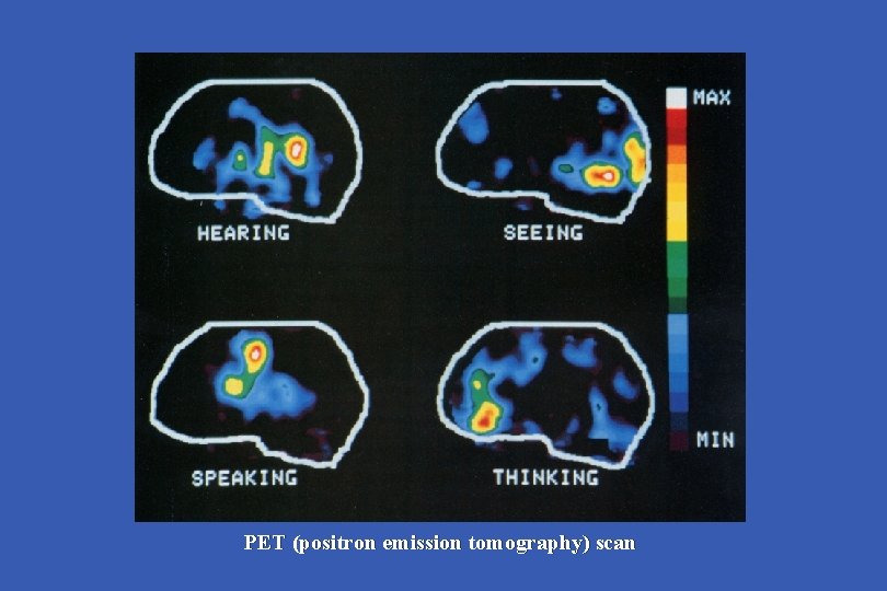 PET (positron emission tomography) scan 