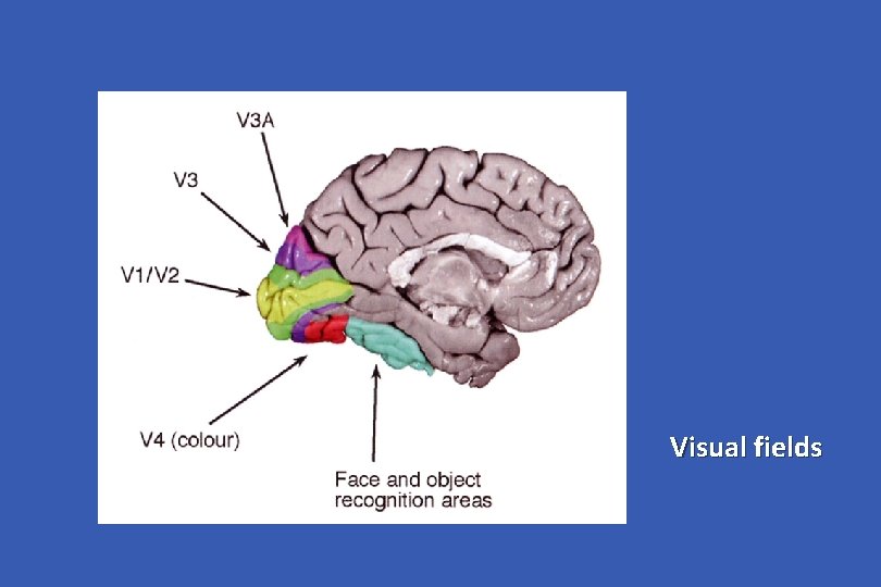 Visual fields 