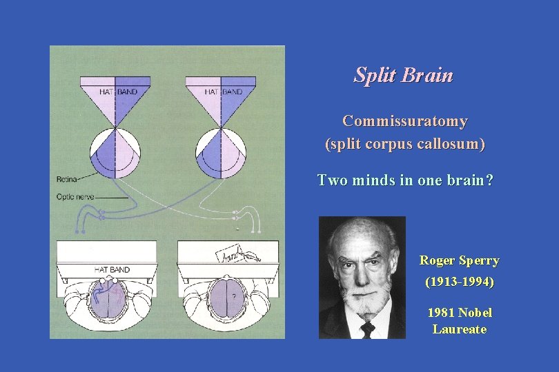Split Brain Commissuratomy (split corpus callosum) Two minds in one brain? Roger Sperry (1913