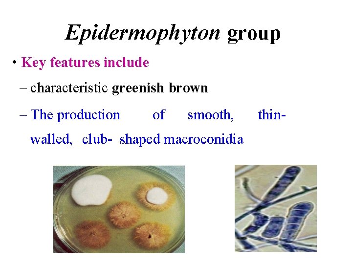 Epidermophyton group • Key features include – characteristic greenish brown – The production of