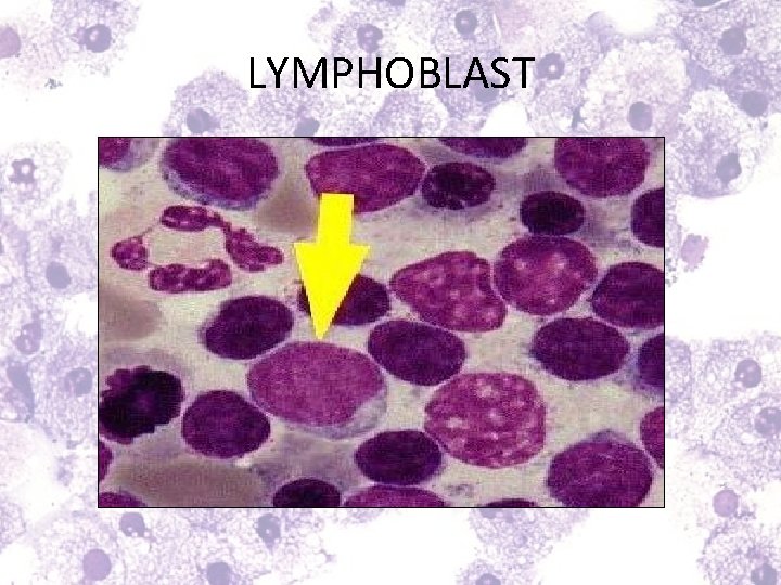 LYMPHOBLAST 