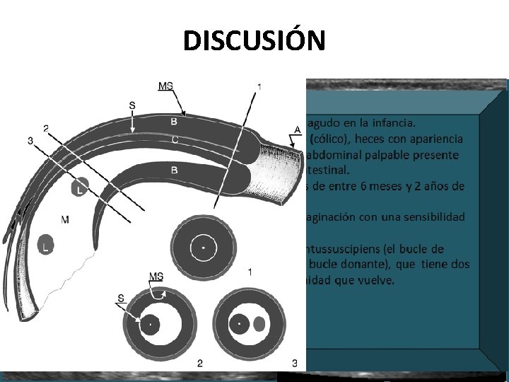 DISCUSIÓN 