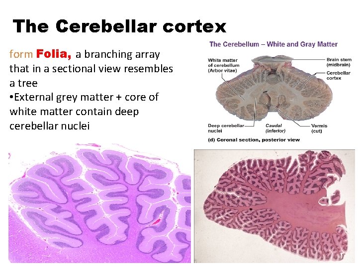 The Cerebellar cortex form Folia, a branching array that in a sectional view resembles