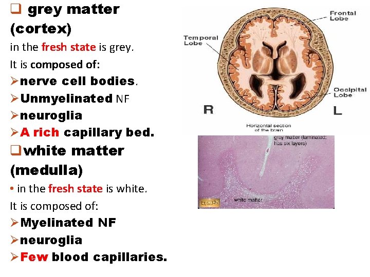 q grey matter (cortex) in the fresh state is grey. It is composed of: