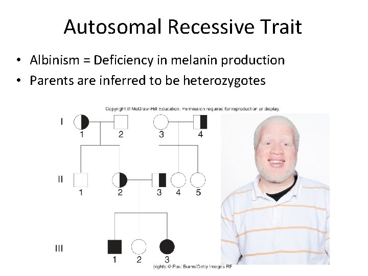 Autosomal Recessive Trait • Albinism = Deficiency in melanin production • Parents are inferred