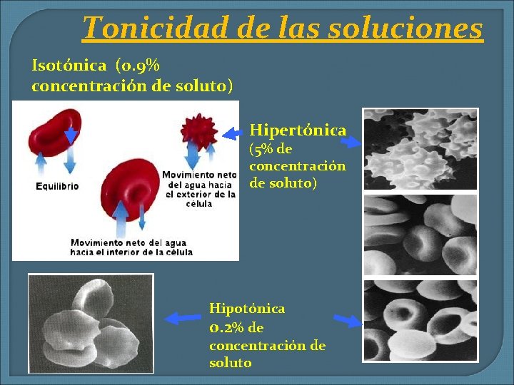 Tonicidad de las soluciones Isotónica (0. 9% concentración de soluto) Hipertónica (5% de concentración