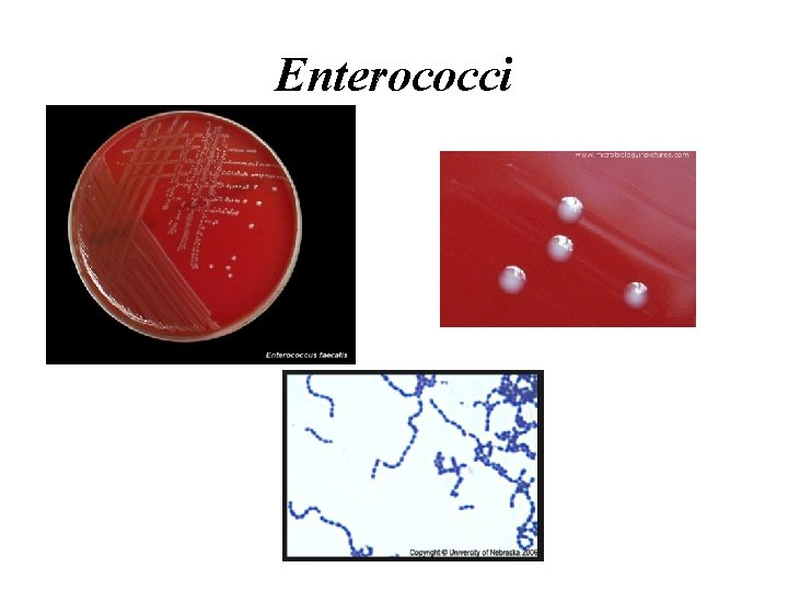 Enterococci 