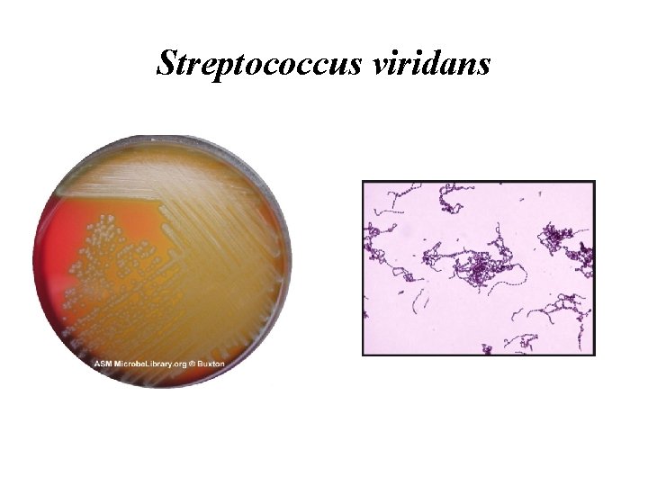 Streptococcus viridans 