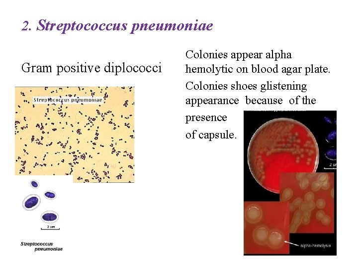 2. Streptococcus pneumoniae Gram positive diplococci Colonies appear alpha hemolytic on blood agar plate.