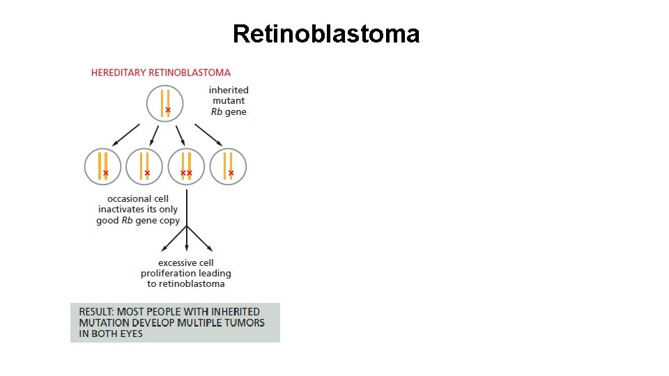 Retinoblastoma 