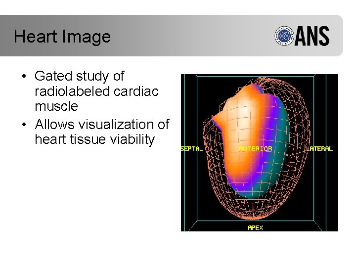 Heart Image • Gated study of radiolabeled cardiac muscle • Allows visualization of heart