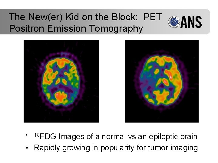 The New(er) Kid on the Block: PET Positron Emission Tomography • 18 FDG Images