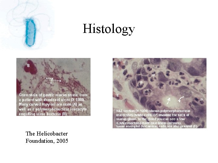 Histology The Helicobacter Foundation, 2005 