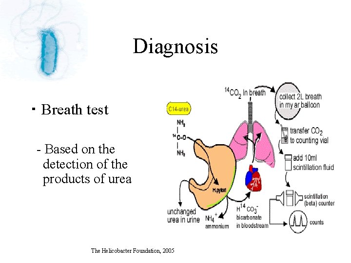 Diagnosis ・ Breath test - Based on the detection of the products of urea