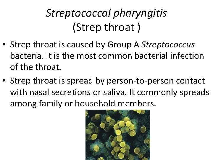 Streptococcal pharyngitis (Strep throat ) • Strep throat is caused by Group A Streptococcus