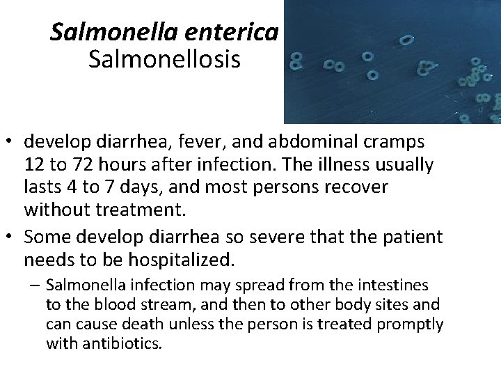 Salmonella enterica Salmonellosis • develop diarrhea, fever, and abdominal cramps 12 to 72 hours