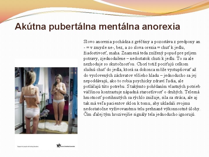 Akútna pubertálna mentálna anorexia Slovo anorexia pochádza z gréčtiny a pozostáva z predpony an