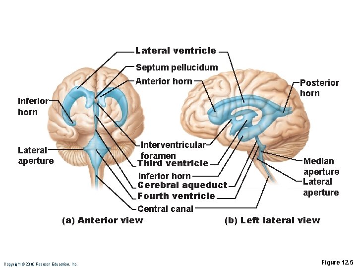 Lateral ventricle Septum pellucidum Anterior horn Inferior horn Lateral aperture Interventricular foramen Third ventricle