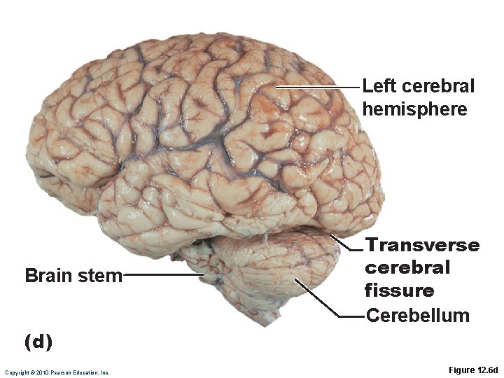 Left cerebral hemisphere Brain stem Transverse cerebral fissure Cerebellum (d) Copyright © 2010 Pearson