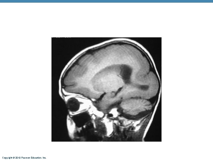 Copyright © 2010 Pearson Education, Inc. 