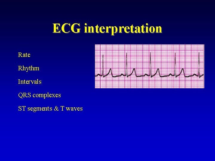 ECG interpretation Rate Rhythm Intervals QRS complexes ST segments & T waves 