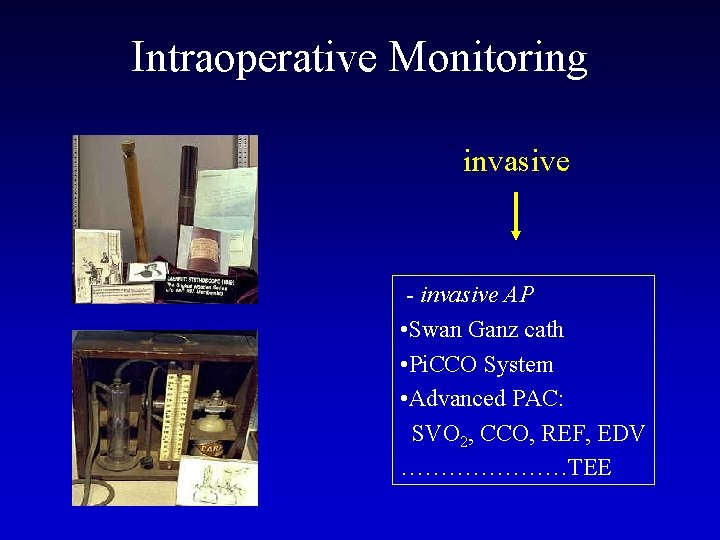 Intraoperative Monitoring invasive - invasive AP • Swan Ganz cath • Pi. CCO System
