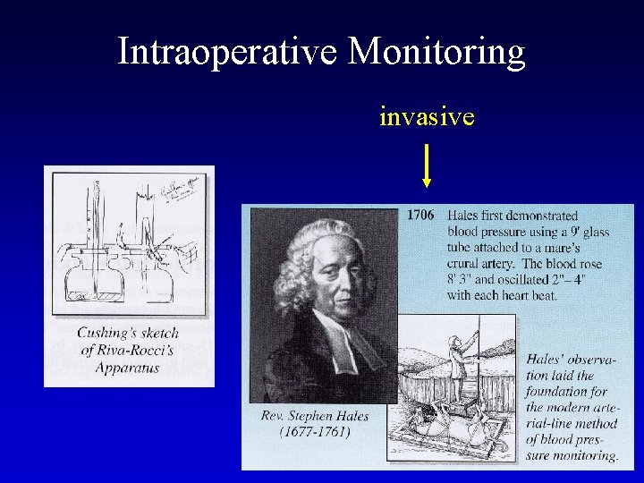 Intraoperative Monitoring invasive 