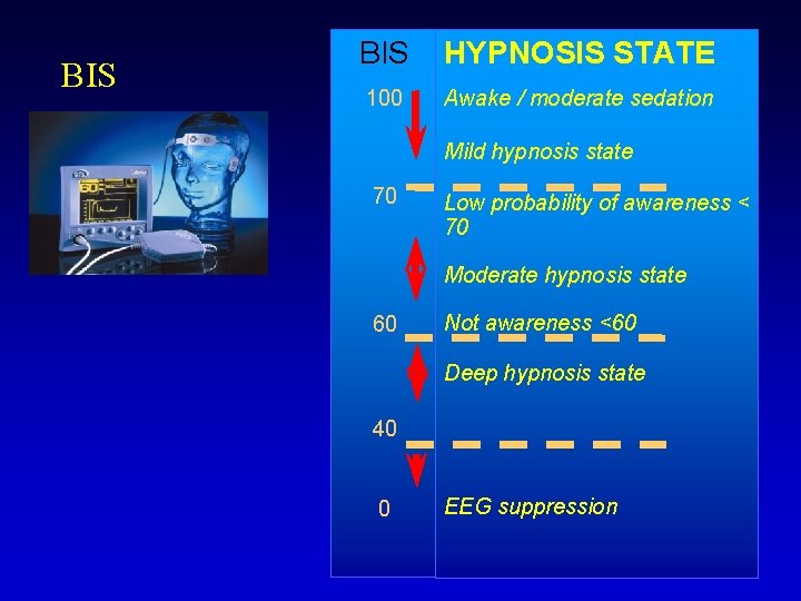 BIS HYPNOSIS STATE 100 Awake / moderate sedation Mild hypnosis state 70 Low probability