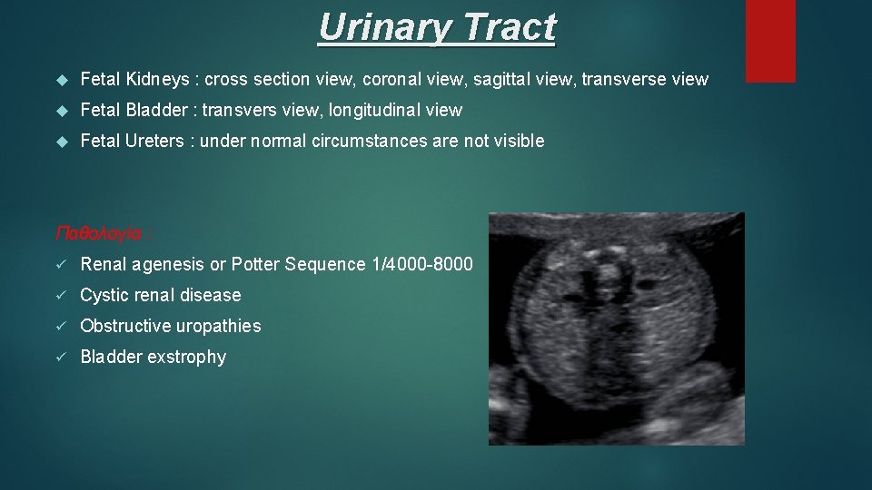 Urinary Tract Fetal Kidneys : cross section view, coronal view, sagittal view, transverse view