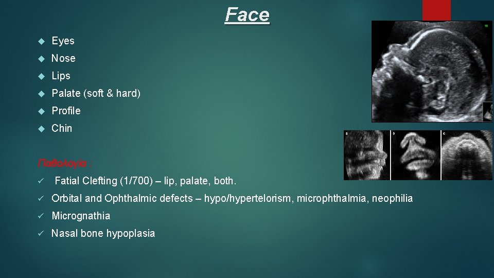 Face Eyes Nose Lips Palate (soft & hard) Profile Chin Παθολογία : ü Fatial