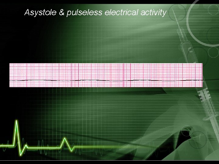 Asystole & pulseless electrical activity 