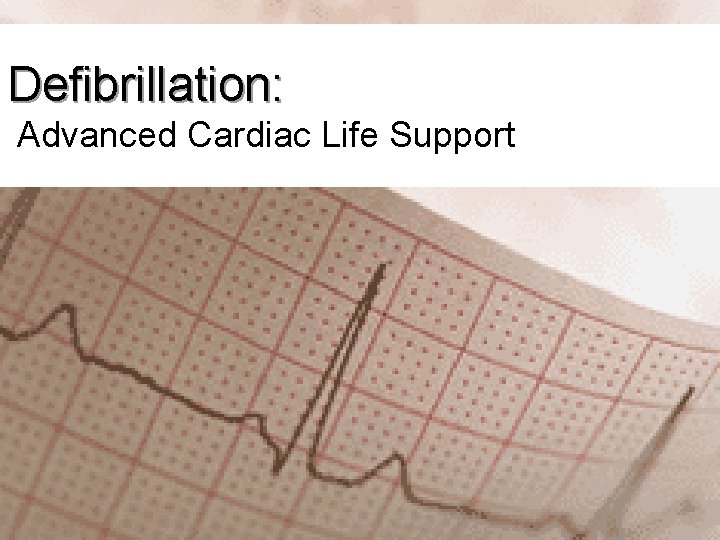 Defibrillation: Advanced Cardiac Life Support 