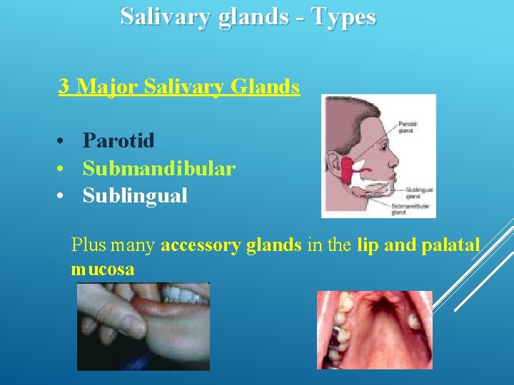 Salivary glands - Types 3 Major Salivary Glands • Parotid • Submandibular • Sublingual Salivary glands - Types 3 Major Salivary Glands • Parotid • Submandibular • Sublingual