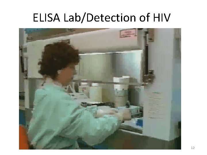 ELISA Lab/Detection of HIV 12 