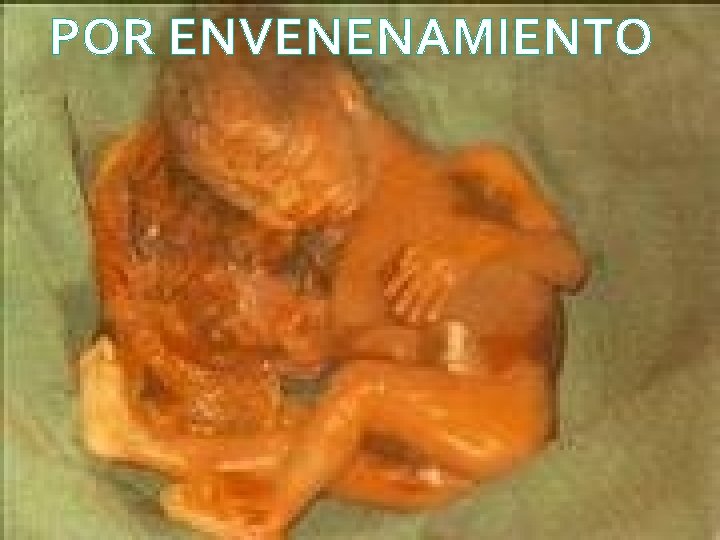 POR ENVENENAMIENTO 