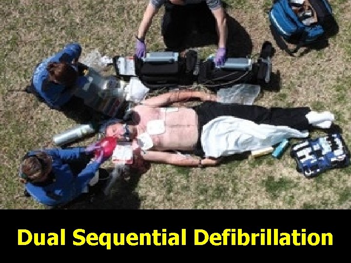 Dual Sequential Defibrillation 