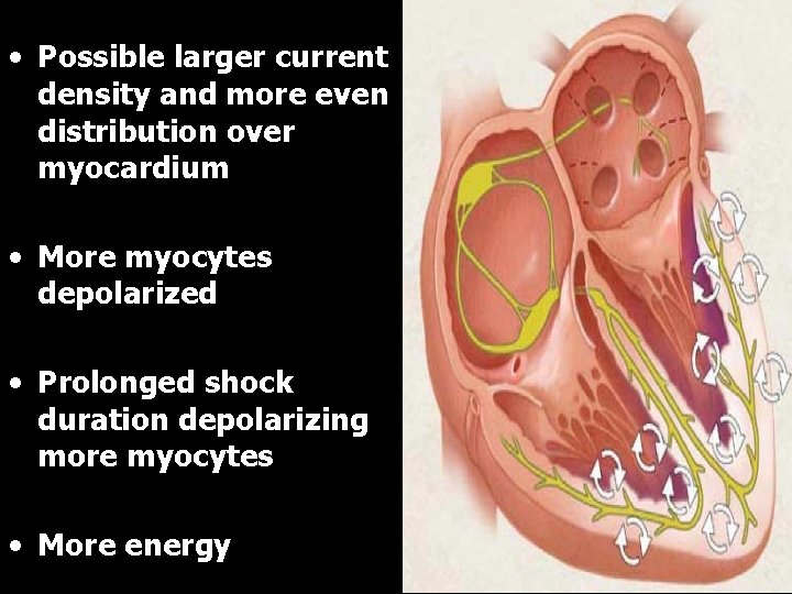  • Possible larger current density and more even distribution over myocardium • More
