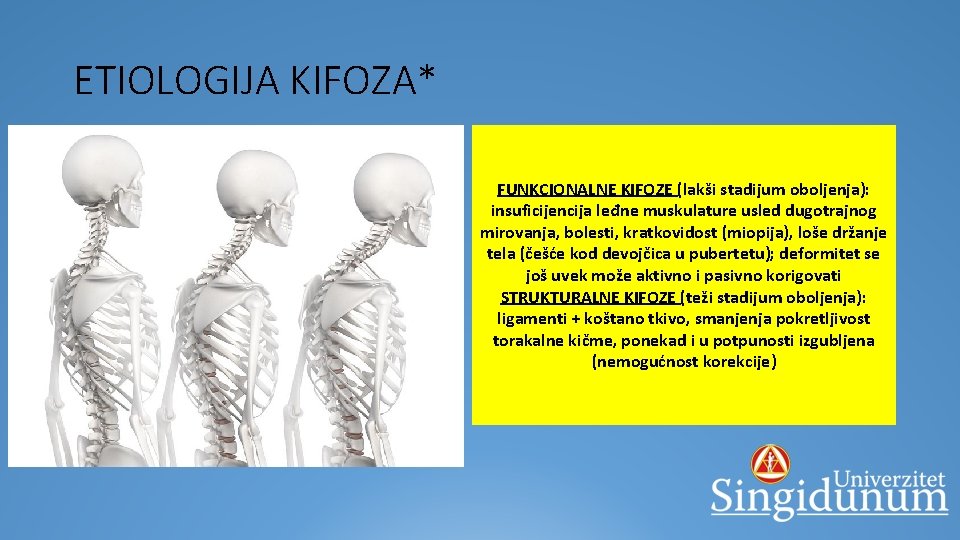 ETIOLOGIJA KIFOZA* § urođene (kongenitalne): greške u formiranju elemenata kičmenog stuba § stečene: §