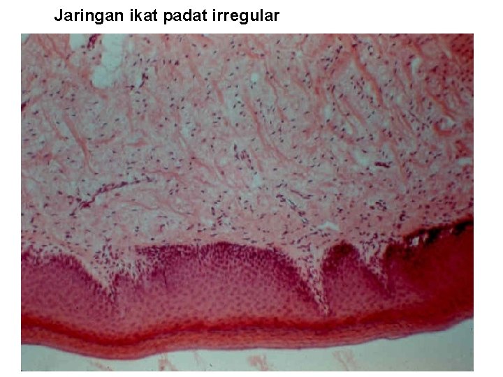 Jaringan ikat padat irregular 