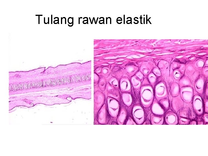 Tulang rawan elastik Tulang rawan elastik