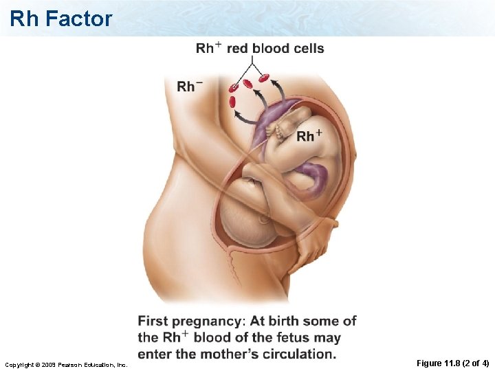 Rh Factor Copyright © 2009 Pearson Education, Inc. Figure 11. 8 (2 of 4)