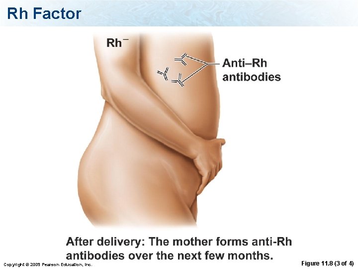 Rh Factor Copyright © 2009 Pearson Education, Inc. Figure 11. 8 (3 of 4)