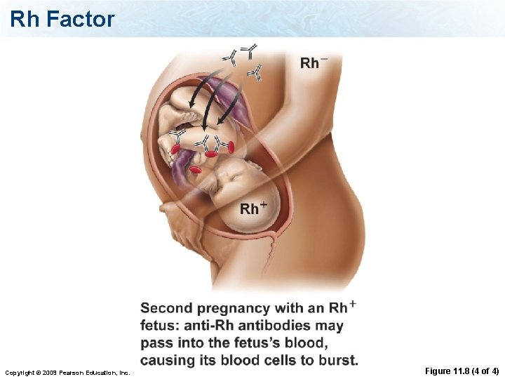 Rh Factor Copyright © 2009 Pearson Education, Inc. Figure 11. 8 (4 of 4)
