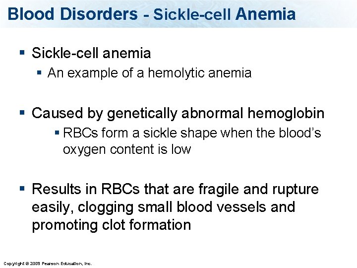 Blood Disorders - Sickle-cell Anemia § Sickle-cell anemia § An example of a hemolytic