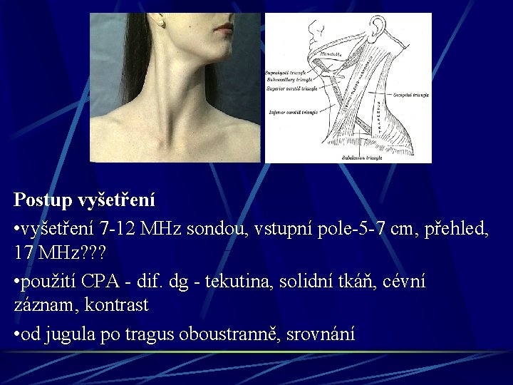 Postup vyšetření • vyšetření 7 -12 MHz sondou, vstupní pole-5 -7 cm, přehled, 17