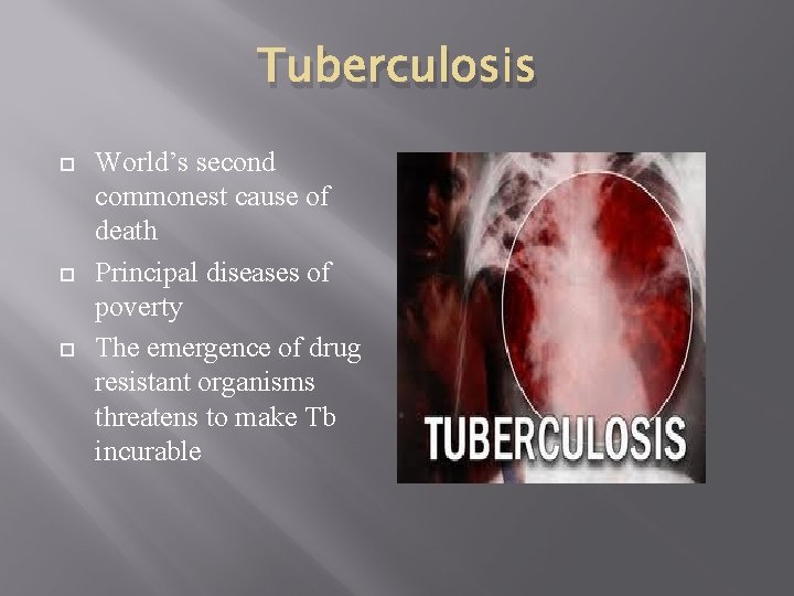 Tuberculosis World’s second commonest cause of death Principal diseases of poverty The emergence of